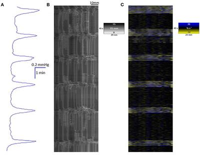 Spatiotemporal Mapping Techniques Show Clozapine Impairs Neurogenic and Myogenic Patterns of Activity in the Colon of the Rabbit in a Dose-Dependent Manner